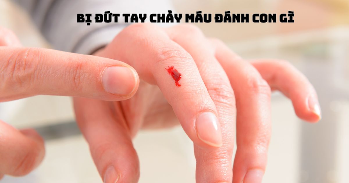 Bị đứt tay chảy máu đánh con gì